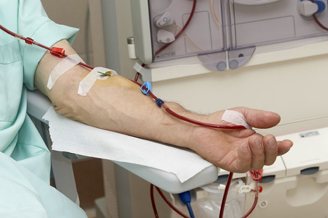 Εξατομικευμένη αιμοκάθαρση. Μελλοντικά ερωτήματα.